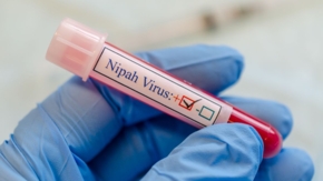 Nipah Virus Foto iStock Manjurul